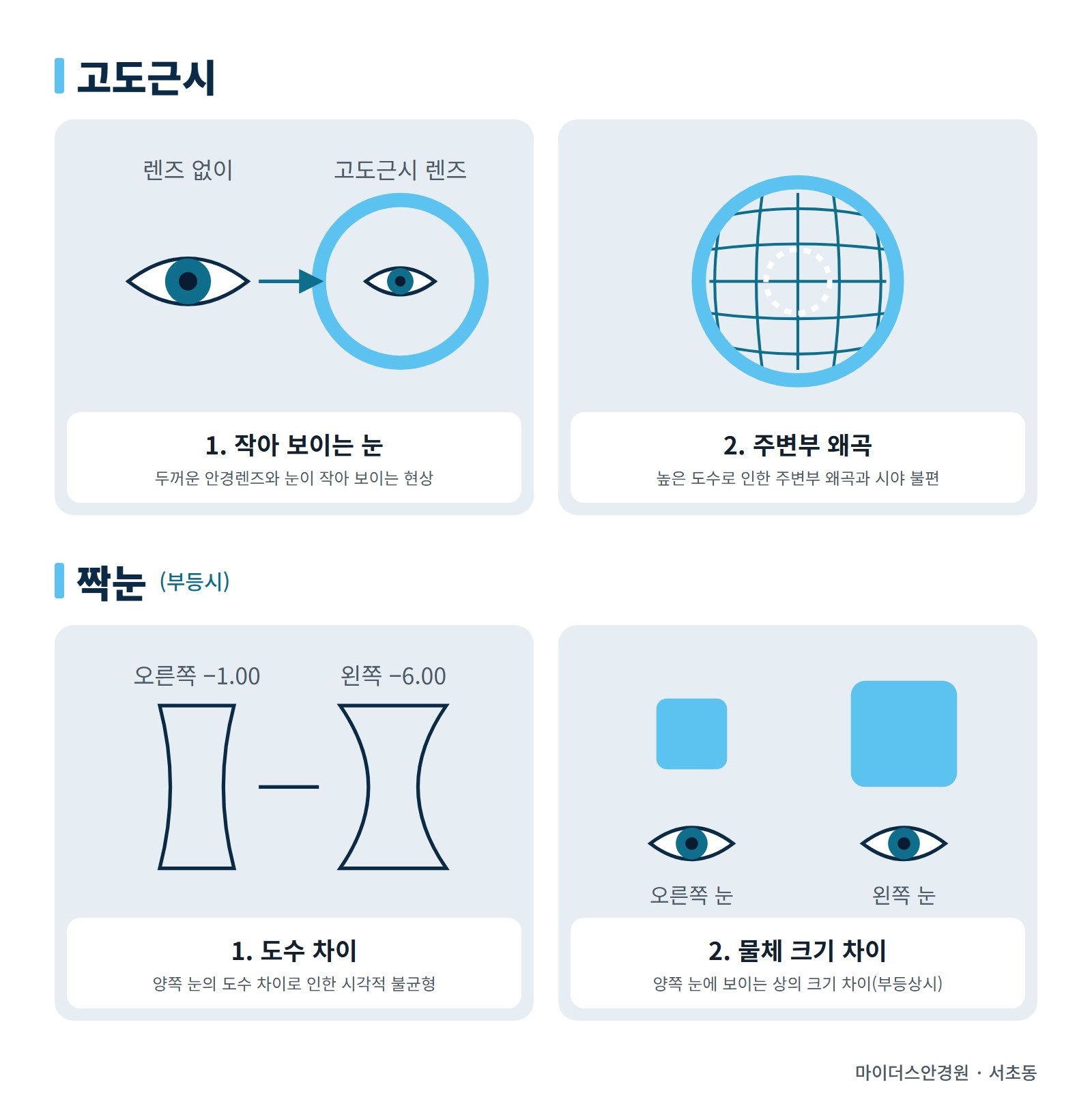 고도근시: 1. 작아 보이는 눈(두꺼운 안경렌즈와 눈이 작아 보이는 현상), 2. 주변부 왜곡(높은 도수로 인한 주변부 왜곡과 시야 불편). 짝눈(부등시): 1. 도수 차이(양쪽 눈의 도수 차이로 인한 시각적 불균형), 2. 물체 크기 차이(양쪽 눈에 보이는 상의 크기 차이, 부등상시)
